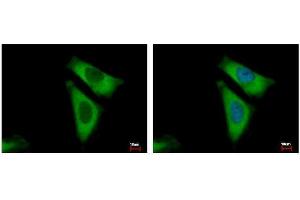 ICC/IF Image RPL29 antibody detects RPL29 protein at cytoplasm by immunofluorescent analysis.
