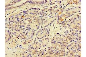 Immunohistochemistry of paraffin-embedded human pancreatic tissue using ABIN7158760 at dilution of 1:100 (LPCAT3 antibody  (AA 306-363))