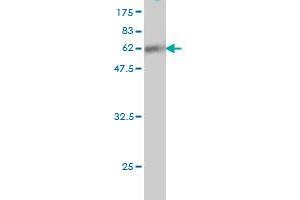 Western Blot detection against Immunogen (61. (SUPT3H/SPT3 antibody  (AA 1-328))