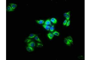 Immunofluorescence staining of Hela cells with ABIN7156945 at 1:133, counter-stained with DAPI. (IMPG2 antibody  (AA 616-759))