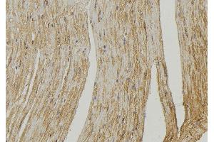 ABIN6272572 at 1/100 staining Mouse muscle tissue by IHC-P.