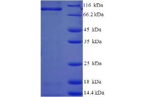 Caprin-1 Protein (AA 2-707) (His-SUMO Tag)