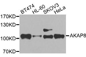 Western blot analysis of extracts of various cell lines, using AKAP8 antibody (ABIN5975842) at 1/500 dilution. (AKAP8 antibody)