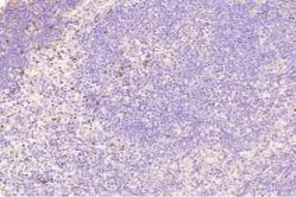 TOX antibody