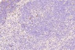 Immunohistochemistry analysis of paraffin-embedded mouse thymus using,TOX(ABIN7075899) at dilution of 1: 4000 (TOX antibody)