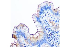 Immunohistochemistry of paraffin-embedded human appendix using CE Rabbit mAb (ABIN7266083) at dilution of 1:100 (40x lens).