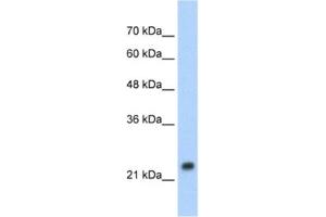 Western Blotting (WB) image for anti-Heat Shock 27kDa Protein 1 (HSPB1) antibody (ABIN2460181) (HSP27 antibody)