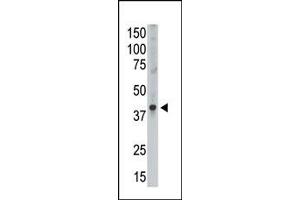 Image no. 1 for anti-Melanoma Antigen Family A, 9 (MAGEA9) (Middle Region) antibody (ABIN358651) (MAGEA9 antibody  (Middle Region))
