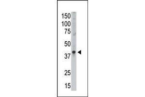 Image no. 1 for anti-Melanoma Antigen Family A, 9 (MAGEA9) (Middle Region) antibody (ABIN358651)