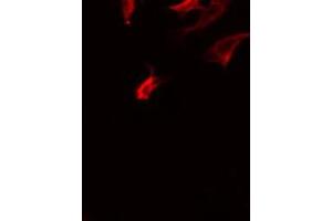 ABIN6275874 staining COLO205 by IF/ICC. (LY75/DEC-205 antibody  (Internal Region))