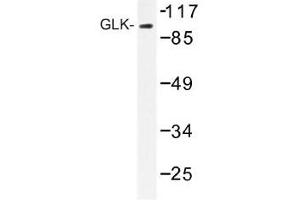 Image no. 1 for anti-Mitogen-Activated Protein Kinase Kinase Kinase Kinase 3 (MAP4K3) antibody (ABIN317719) (MAP4K3 antibody)