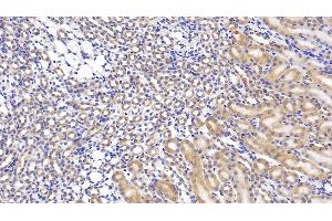 Detection of HSPA5 in Mouse Kidney Tissue using Monoclonal Antibody to Heat Shock 70 kDa Protein 5 (HSPA5)