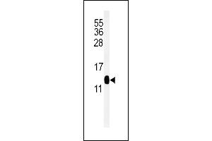 Western blot analysis of DC13 Antibody (N-term) (ABIN651108 and ABIN2840074) in mouse kidney tissue lysates (35 μg/lane).