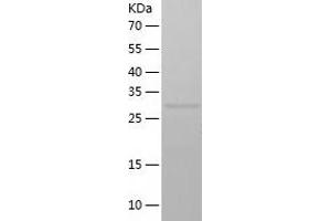 GNB2L1 Protein (AA 1-317) (His tag)