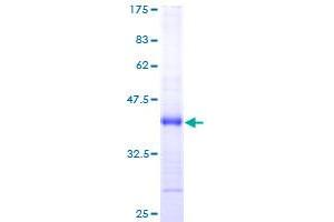NDUFS6 Protein (AA 1-124) (GST tag)