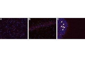 Expression of B1 bradykinin receptor in rat CNSImmunohistochemical staining of frozen rat brain section (A & B) and cerebellum (C) using Anti-B1 Bradykinin Receptor (BDKRB1) Antibody (ABIN7042967, ABIN7043940 and ABIN7043941), (1:50). (Bradykinin Receptor B1 (BDKRB1) Peptide)