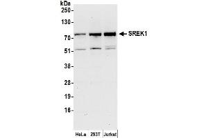 anti-Splicing Regulatory Glutamine/lysine-Rich Protein 1 (SREK1) (AA 458-508) antibody