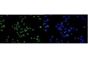 IF analysis of TPR using anti-TPR antibody (ABIN7603243).