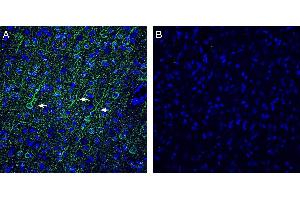 Expression of Vasopressin V1A Receptor in rat frontal cortex. (AVPR1A antibody  (Intracellular))