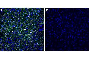 Expression of Vasopressin V1A Receptor in rat frontal cortex. (AVPR1A antibody  (C-Term, Intracellular))