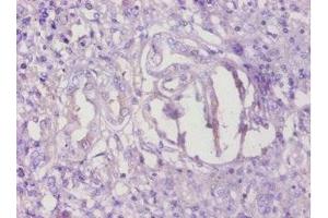 Immunohistochemistry of paraffin-embedded human kidney tissue using ABIN7173071 at dilution of 1:100