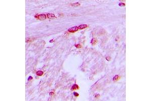 Immunohistochemical analysis of BTF3L4 staining in human brain formalin fixed paraffin embedded tissue section. (BTF3L4 antibody  (Center))