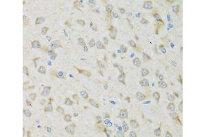 Immunohistochemistry of paraffin-embedded Mouse brain using CLCN7 Polyclonal Antibody at dilution of 1:100 (40x lens). (CLCN7 antibody)