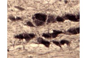 IHC on rat trigeminal nerve (free floating cryo section) using rabbit SORT1 polyclonal antibody  at a dilution of 1 : 1000.