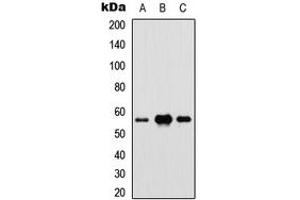 Western blot analysis of IRF5 expression in HEK293T (A), Raw264. (IRF5 antibody  (Center))