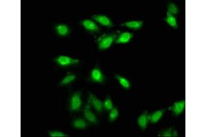 Immunofluorescence staining of Hela cells with ABIN7144009 at 1:66, counter-stained with DAPI.