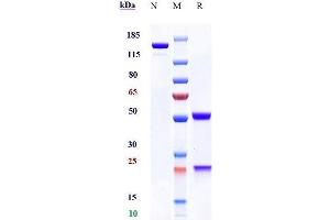 Anti - Human/Mouse CD100( Pepinemab) on SDS-PAGE under reducing (R) condition. (Recombinant SEMA4D (Pepinemab Biosimilar) antibody)