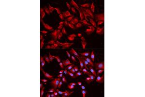 Immunofluorescence analysis of HeLa cells using BCL2L13 antibody (ABIN5970460). (BCL2L13 antibody)