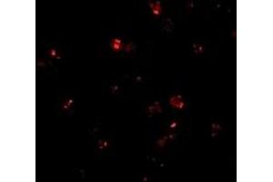 Immunofluorescence (IF) image for anti-Presenilin Enhancer 2 Homolog (PSENEN) (C-Term) antibody (ABIN1030574) (PEN2 antibody  (C-Term))