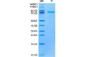 Cynomolgus LRRC15 on Tris-Bis PAGE under reduced condition. (LRRC15 Protein (AA 22-538) (His tag))