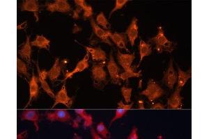 Immunofluorescence analysis of C6 cells using HSD17B1 Polyclonal Antibody at dilution of 1:100 (40x lens). (HSD17B1 antibody)