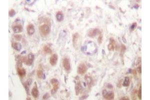 Immunohistochemistry analyzes of Rad52 antibody in paraffin-embedded human testis tissue. (RAD52 antibody)