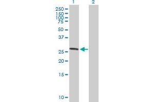 Western Blot analysis of ASB7 expression in transfected 293T cell line by ASB7 MaxPab polyclonal antibody.