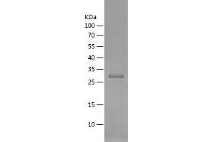 Western Blotting (WB) image for Chemokine (C-X-C Motif) Receptor 4 (CXCR4) (AA 1-80) protein (His-IF2DI Tag) (ABIN7282273) (CXCR4 Protein (AA 1-80) (His-IF2DI Tag))