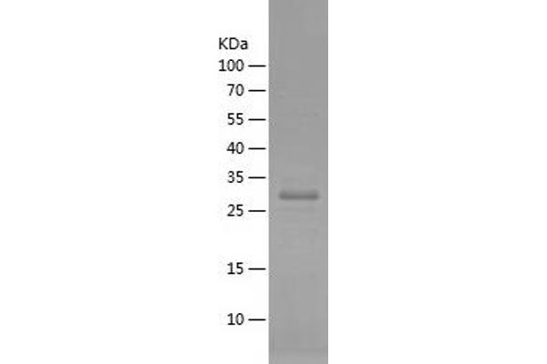 CXCR4 Protein (AA 1-80) (His-IF2DI Tag)