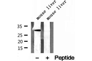 Western blot analysis of extracts of mouse liver tissue, using GNMT antibody. (GNMT antibody  (Internal Region))