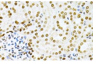 Immunohistochemistry of paraffin-embedded Mouse kidney using DKC1 Polyclonal Antibody at dilution of 1:200 (40x lens). (DKC1 antibody)