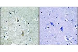 Immunohistochemistry analysis of paraffin-embedded human brain, using B-RAF (Phospho-Ser446) Antibody. (SNRPE antibody  (pSer446))