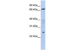 WB Suggested Anti-ZNF510 Antibody Titration:  0. (ZNF510 antibody  (Middle Region))