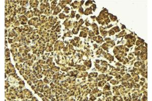 ABIN6269410 at 1/100 staining Mouse pancreas tissue by IHC-P.