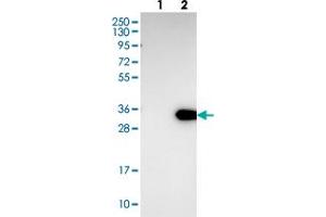 Western blot analysis of Lane 1: Negative control (vector only transfected HEK293T lysate), Lane 2: Over-expression Lysate (Co-expressed with a C-terminal myc-DDK tag (~3. (LRP5L antibody)