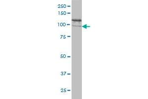 CLCN2 monoclonal antibody (M01), clone 3E1 Western Blot analysis of CLCN2 expression in Hela S3 NE . (CLCN2 antibody  (AA 38-387))