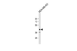 Anti-LN2L Antibody (C-term) at 1:1000 dilution + MDA-MB-453 whole cell lysate Lysates/proteins at 20 μg per lane.