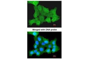 ICC/IF Image Immunofluorescence analysis of paraformaldehyde-fixed A431, using ZNF259, antibody at 1:200 dilution. (ZNF259 antibody  (Center))