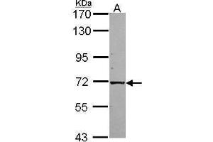 WB Image Sample (30 ug of whole cell lysate) A: A549 7. (KLC1 antibody)