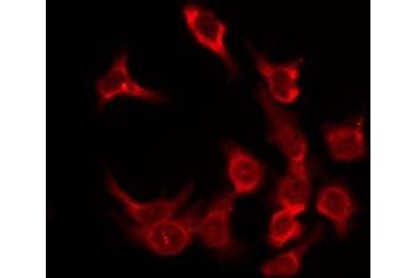 OR5F1 antibody  (C-Term)